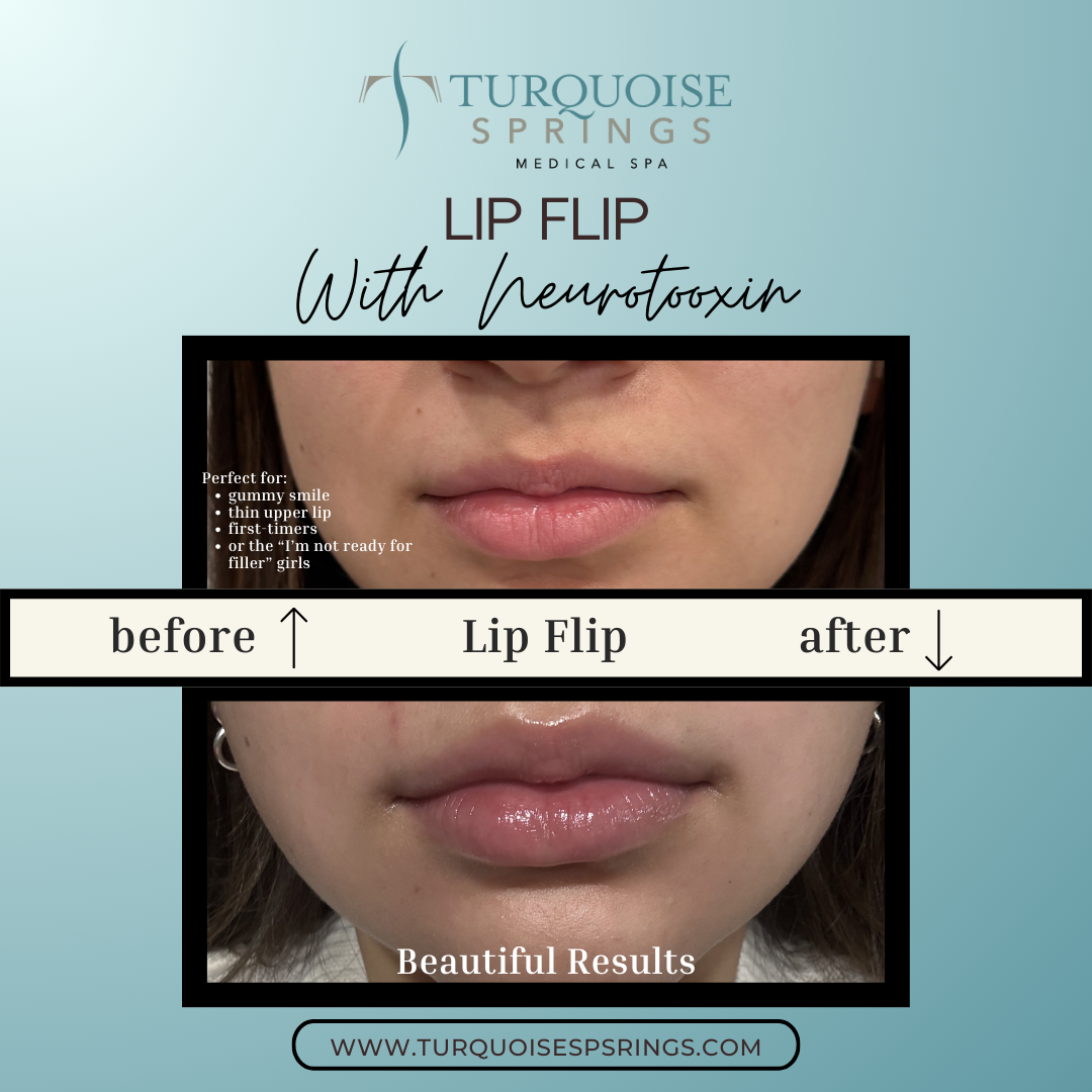Lip Flip
