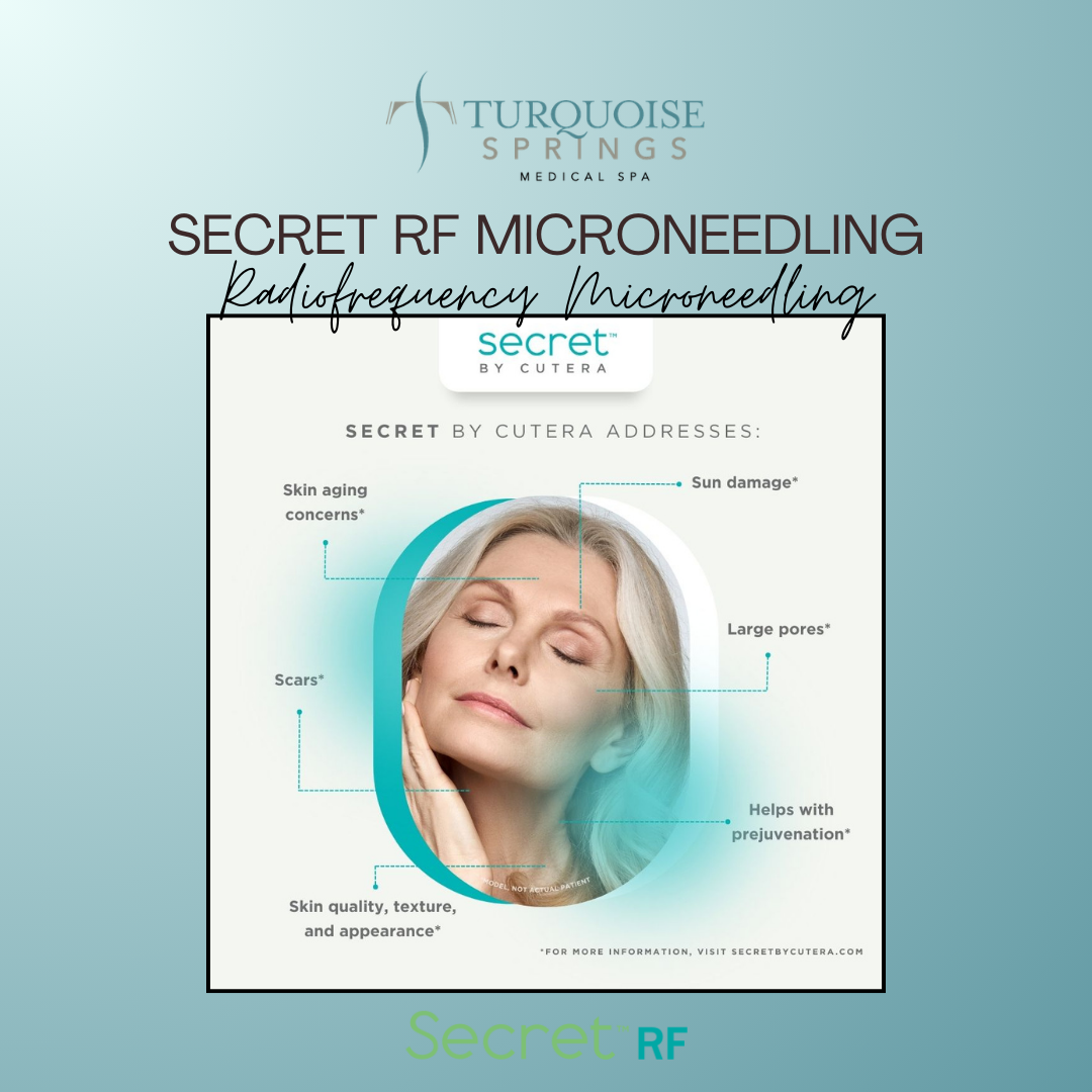 Secret RF (Face/Neck) Microneedling by Cutera