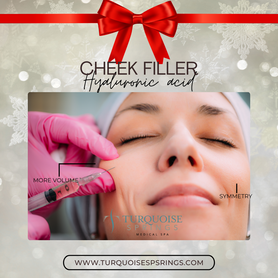 Cheek Filler (Save: $150 on 2 syringes)