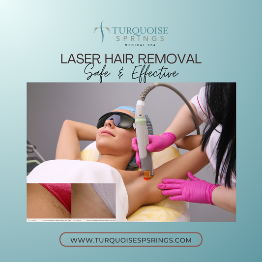 Laser Hair Removal