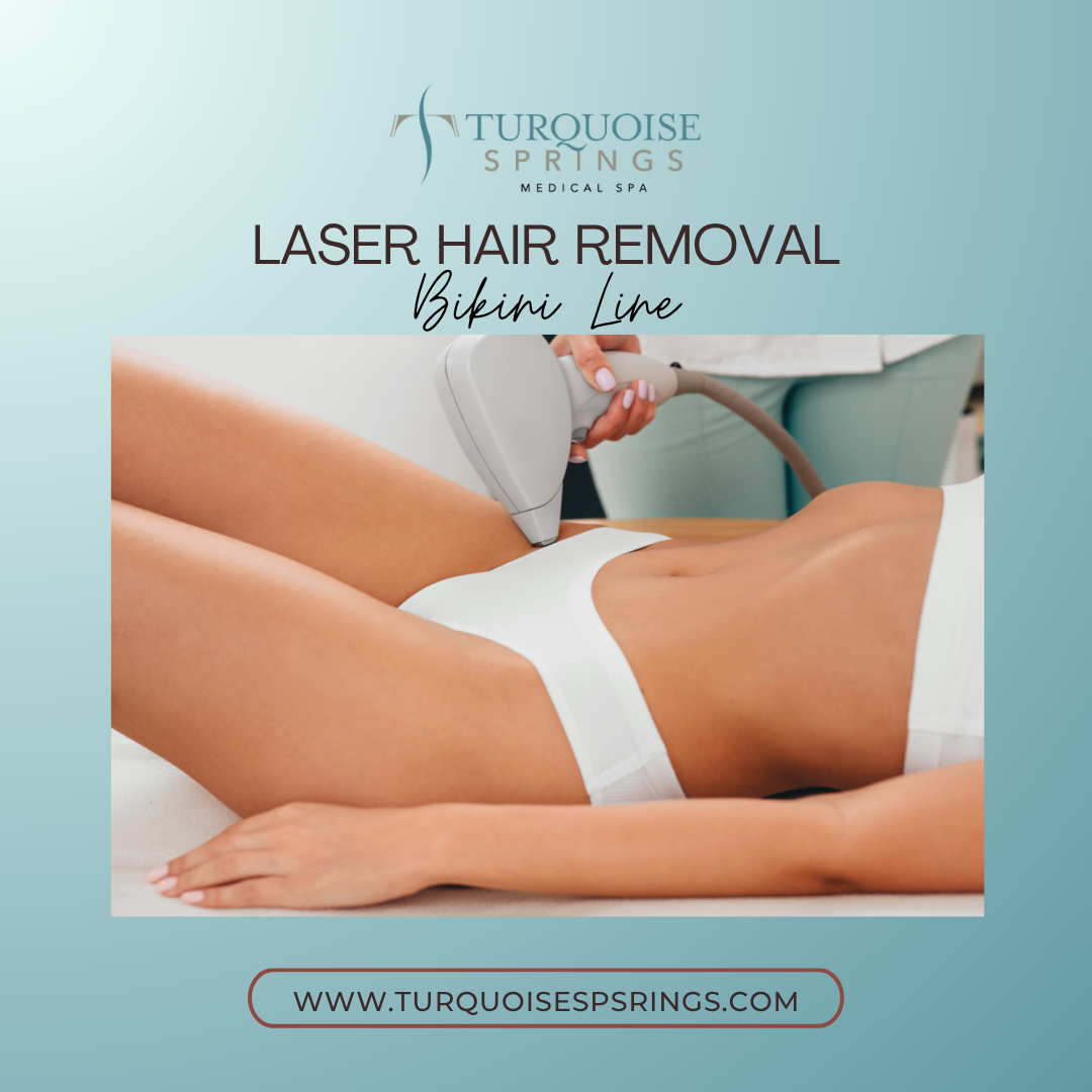 Laser Hair Removal