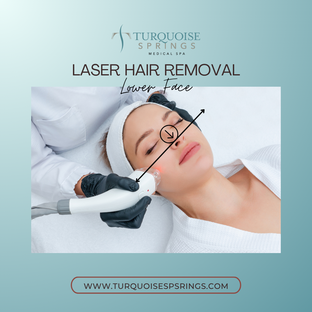 Laser Hair Removal