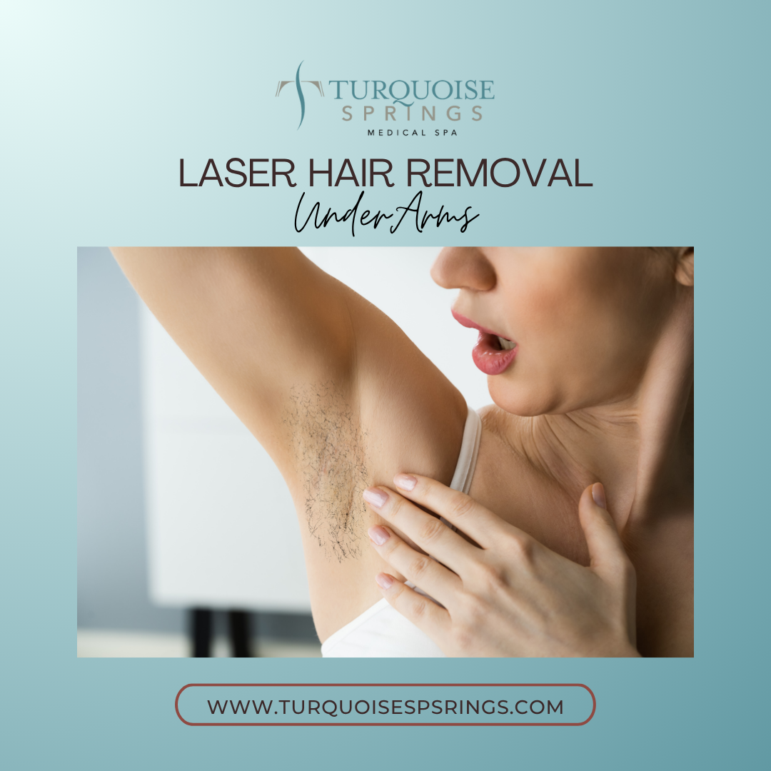 Laser Hair Removal