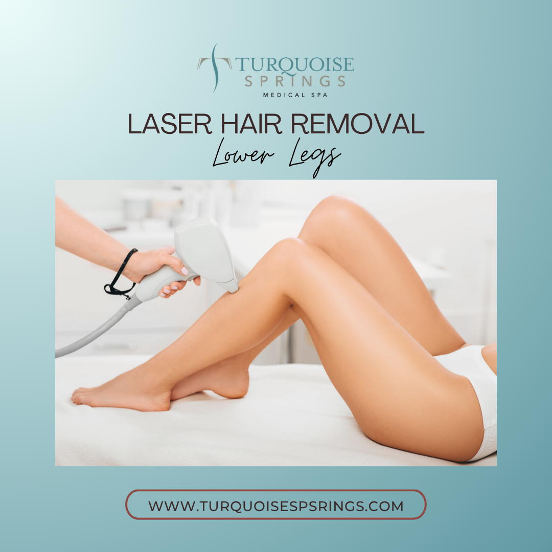 Laser Hair Removal