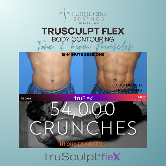 Trusculpt Flex - Tone and Firm Muscles