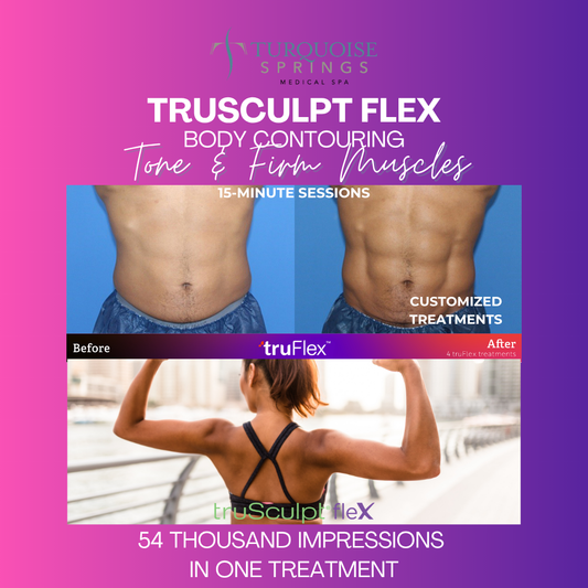 BOGO 1/2 Off~Trusculpt Flex - Tone and Firm Muscles