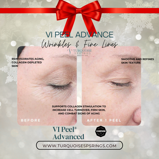 VI Peel Advanced (PROMO: Save $100 when you buy 3)