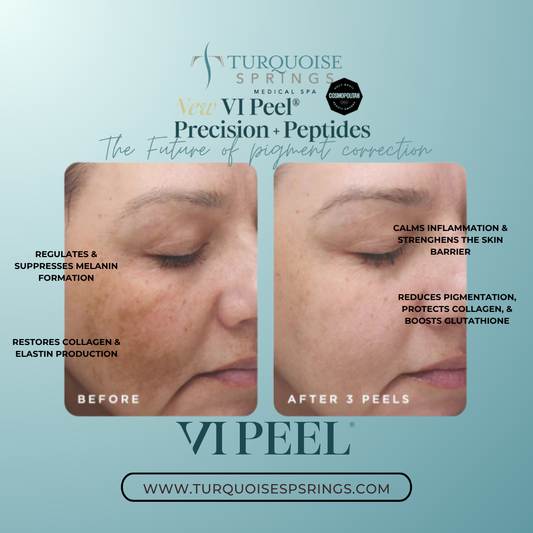 VI Peel Precision + Peptides